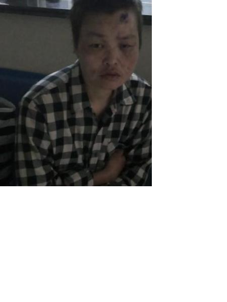流浪人员史珍照片，让爱回家