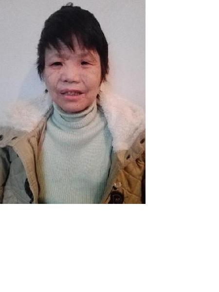 流浪人员女无名氏002照片，让爱回家