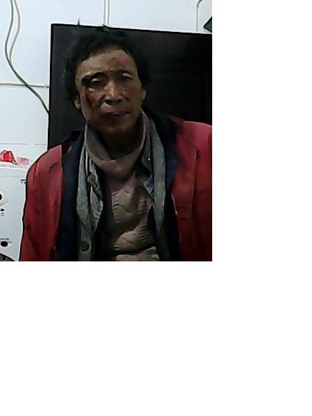 流浪人员救302-020照片，让爱回家