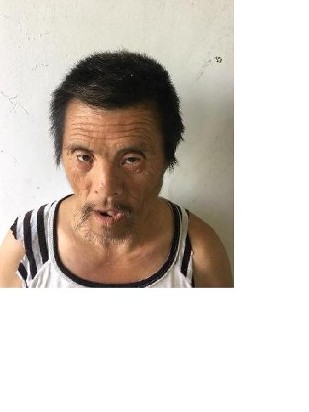 流浪人员符离8号照片，让爱回家