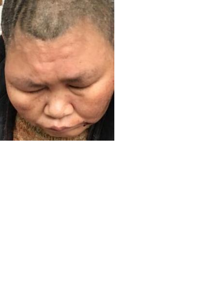 流浪人员无名氏照片，让爱回家