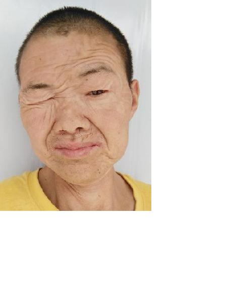 流浪人员无名氏男20杨林芝照片，让爱回家