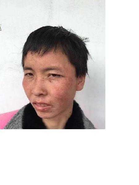 流浪人员芦岭3号照片，让爱回家