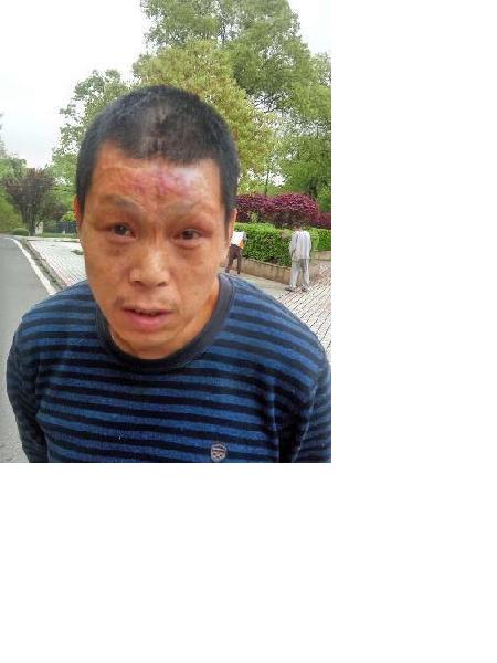 流浪人员无名氏(宁救703)照片，让爱回家