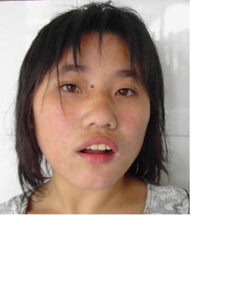 流浪人员痴呆女照片，让爱回家