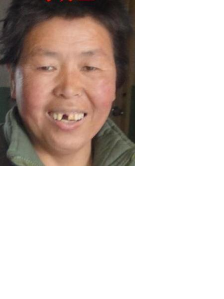 流浪人员无名氏照片，让爱回家