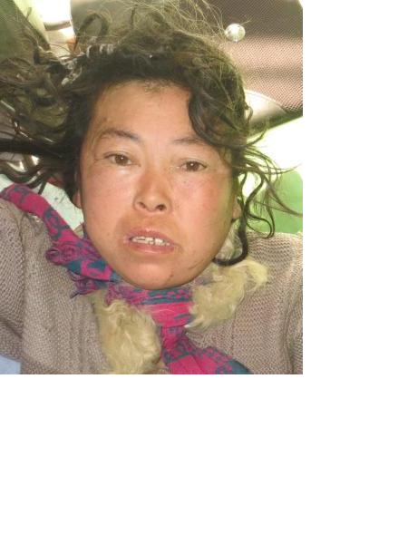 流浪人员李女士照片，让爱回家
