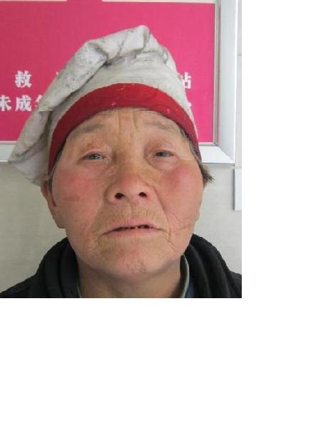 流浪人员无名女175号照片，让爱回家