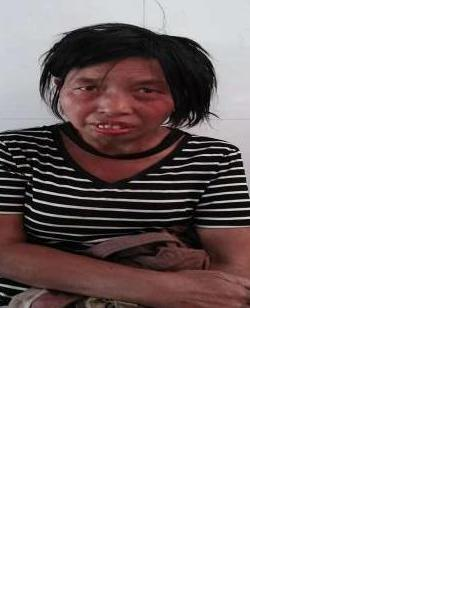 流浪人员无名女照片，让爱回家