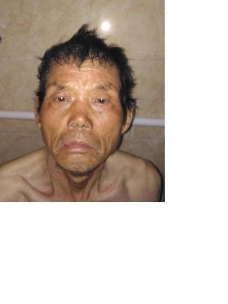 流浪人员无名氏1照片，让爱回家