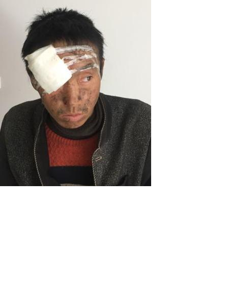 流浪人员渝云无名氏23号照片，让爱回家