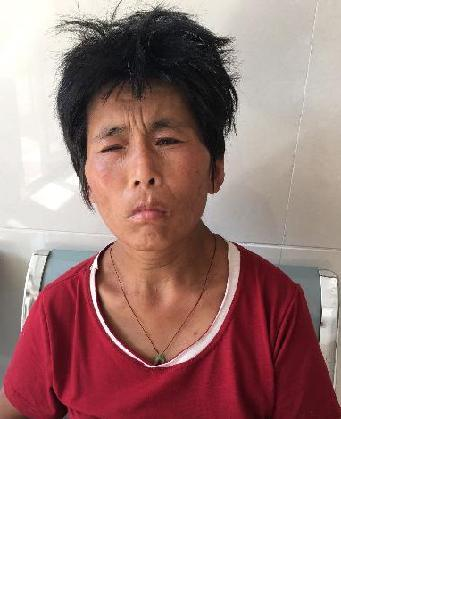 流浪人员无名女345照片，让爱回家