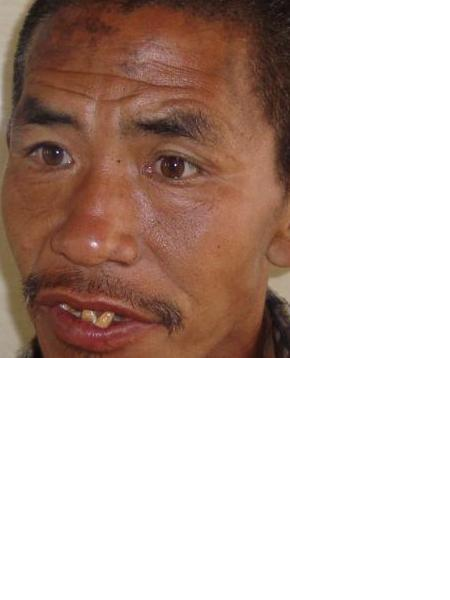 流浪人员无名氏照片，让爱回家