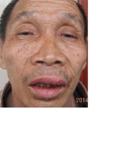 流浪人员无名男81号照片，让爱回家