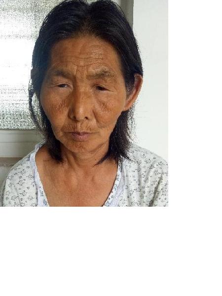 流浪人员无名氏（自述丁容）照片，让爱回家