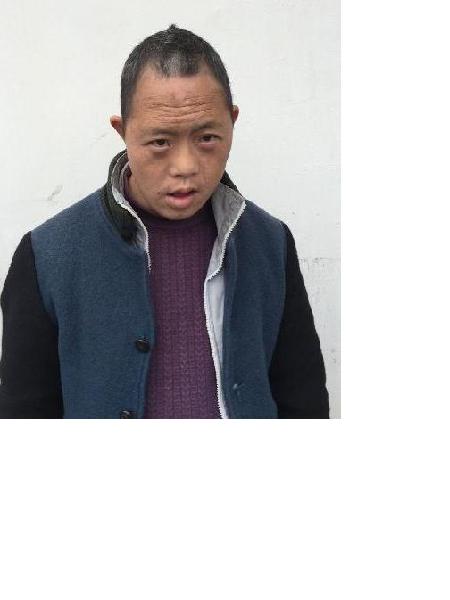 流浪人员救康馨022照片，让爱回家
