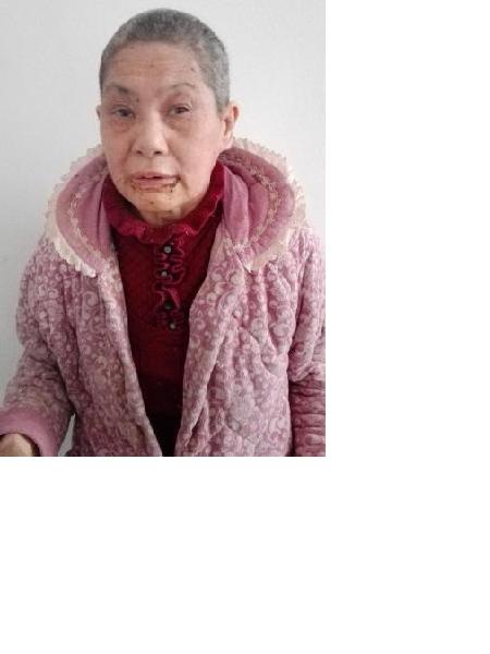 流浪人员女无名氏009照片，让爱回家