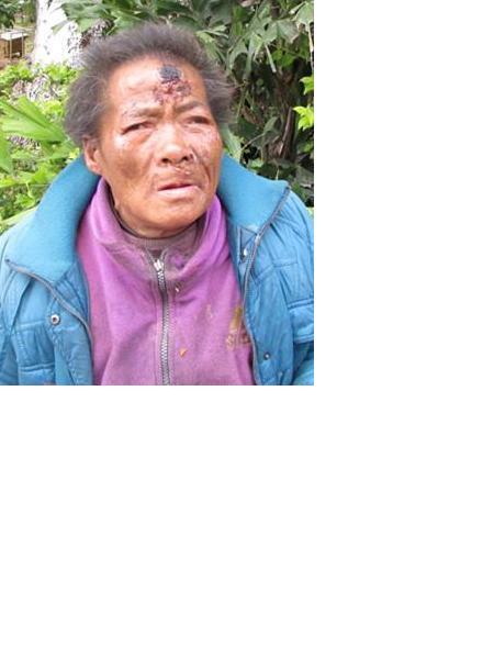 流浪人员浔救69（浔桂坤）照片，让爱回家