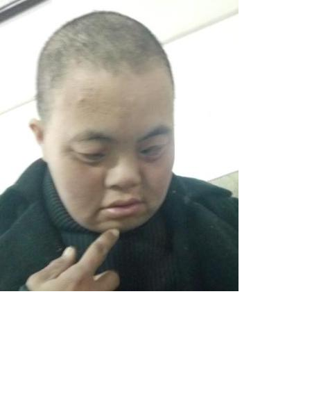 流浪人员德流13照片，让爱回家