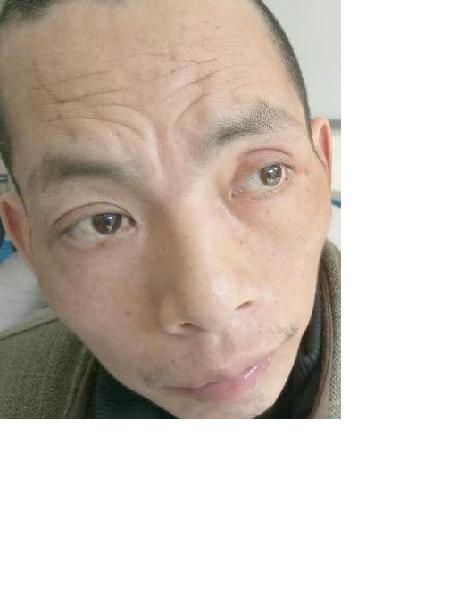 流浪人员李红庆照片，让爱回家