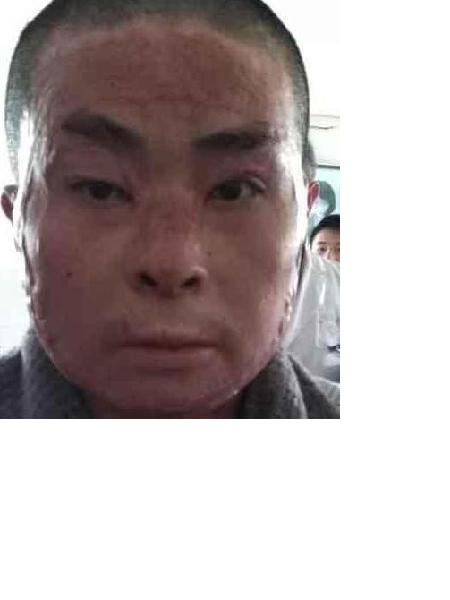流浪人员050何春伟男(康复医院)照片，让爱回家