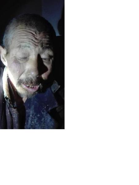 流浪人员精神病照片，让爱回家