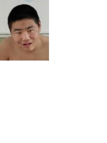 流浪人员无名氏（艾林）照片，让爱回家
