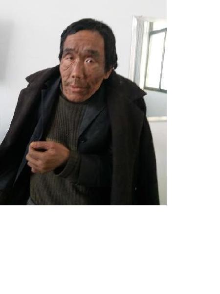流浪人员鹿救30照片，让爱回家