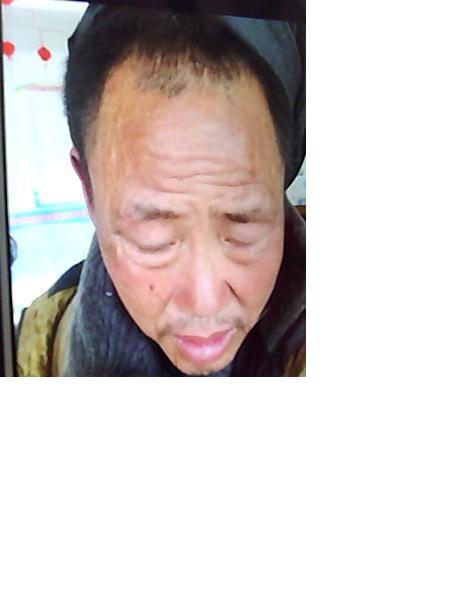 流浪人员无名氏男照片，让爱回家