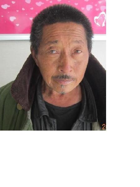 流浪人员无名男151号（陈明清）照片，让爱回家