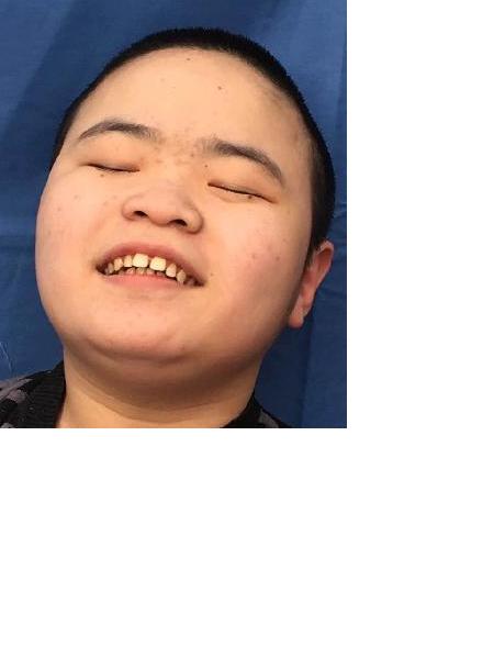 流浪人员新新雨照片，让爱回家