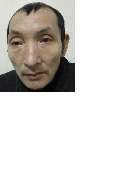 流浪人员潘残联照片，让爱回家