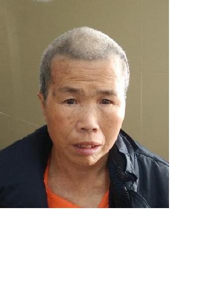 流浪人员33床临救女170613照片，让爱回家
