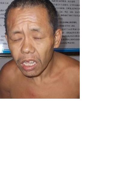 流浪人员无名男照片，让爱回家
