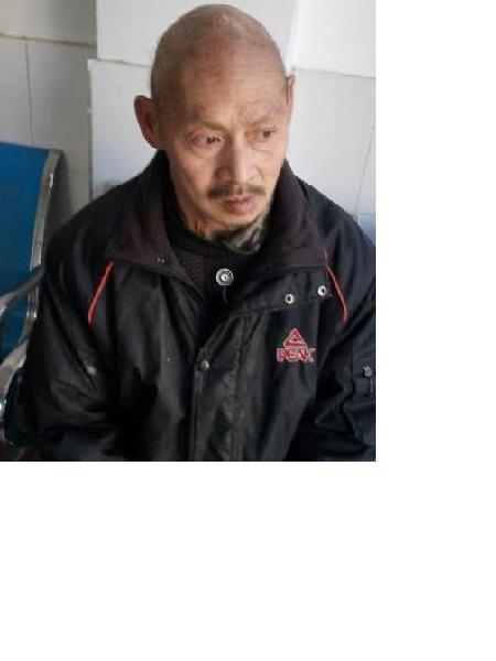 流浪人员无名氏甲照片，让爱回家