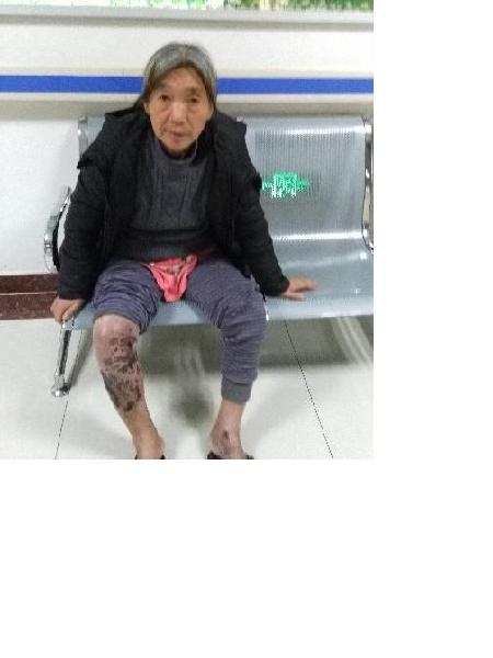 流浪人员杨沙区照片，让爱回家