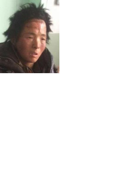 流浪人员无名女5照片，让爱回家