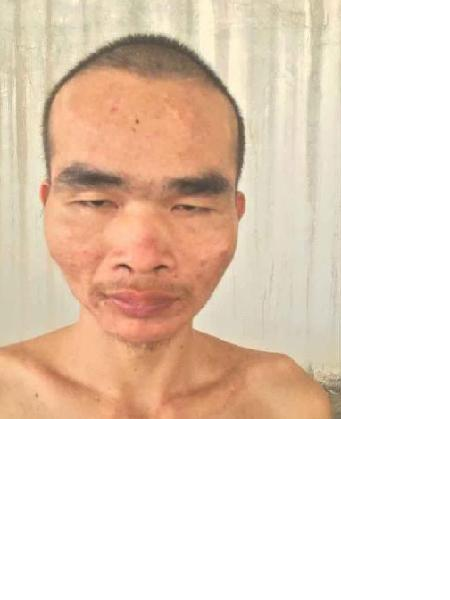 流浪人员无名氏2号照片，让爱回家