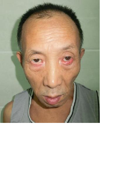 流浪人员无名氏照片，让爱回家
