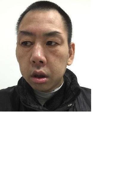 流浪人员无名氏15021号照片，让爱回家