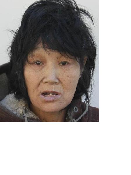 流浪人员无名女67号照片，让爱回家