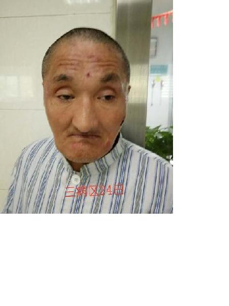 流浪人员无名照片，让爱回家