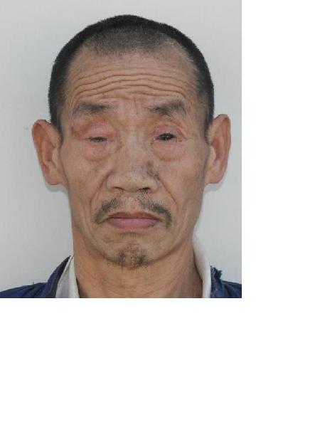流浪人员无名男25号照片，让爱回家