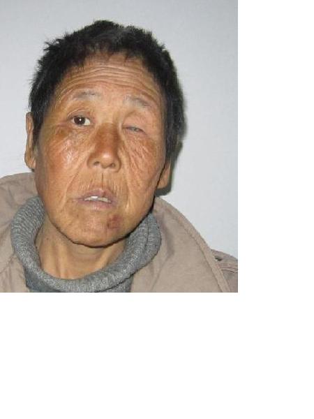 流浪人员73823照片，让爱回家