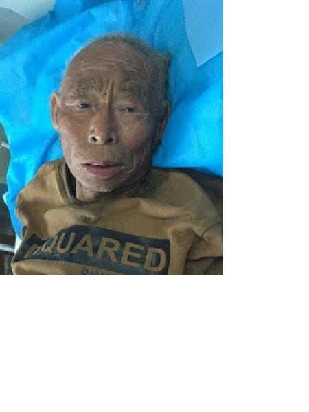流浪人员无名氏170711照片，让爱回家