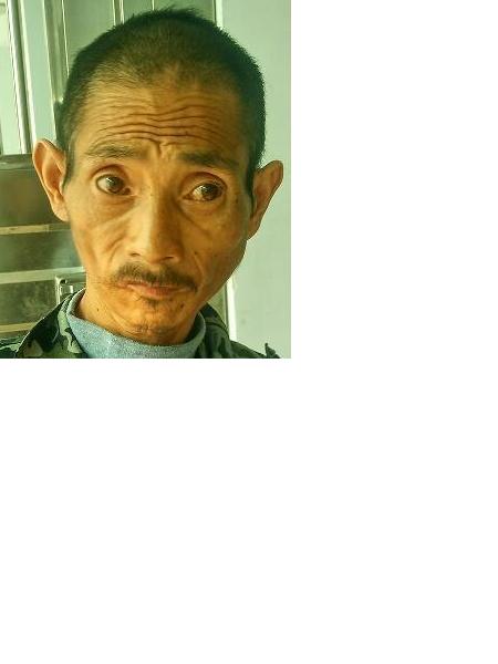 流浪人员无名氏（20160811001）照片，让爱回家