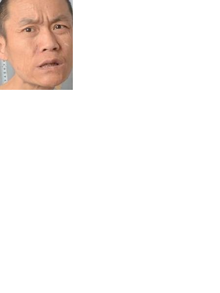 流浪人员015无名氏男（金秋养老院）照片，让爱回家