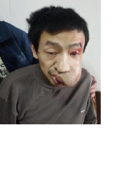 流浪人员无名氏8（赵万忠）照片，让爱回家