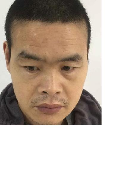 流浪人员029无名氏男(康复医院)照片，让爱回家