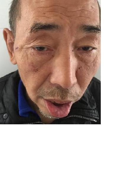 流浪人员黄星照片，让爱回家